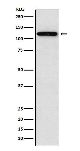 Sortilin