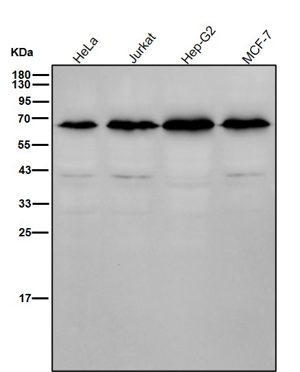 ACVRL1