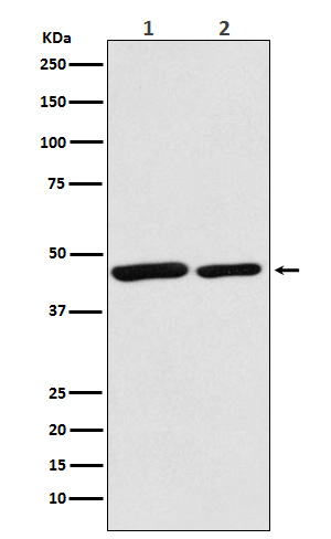 Citrate synthetase