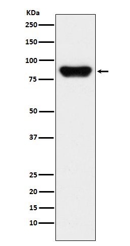 Prothrombin