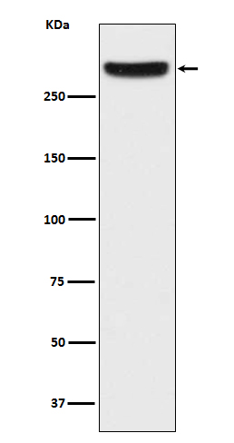 IP3 Receptor