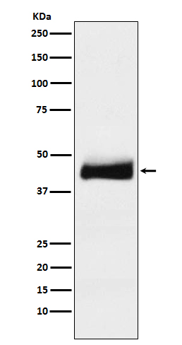 ORM1