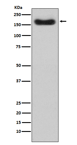 Factor H