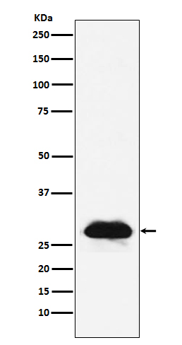 Carbonic anhydrase 2