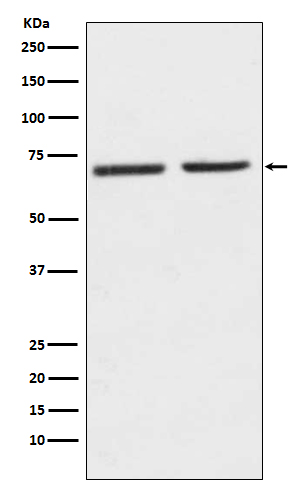 5HT2C Receptor
