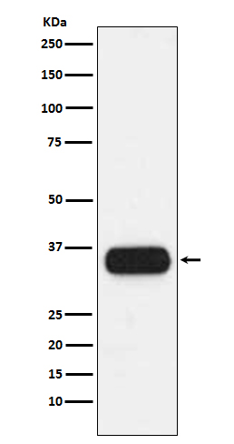HLA-DQA1