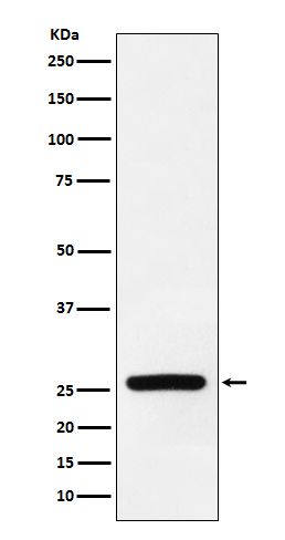 Superoxide Dismutase 3