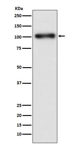 GABA B Receptor 1