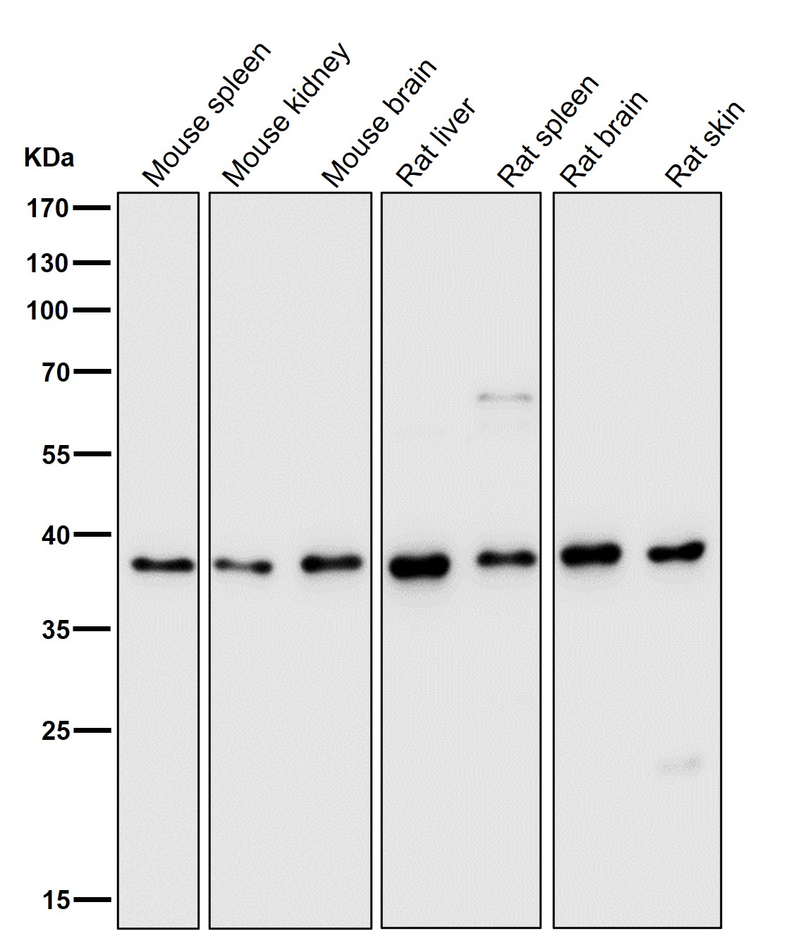 DNA Polymerase beta