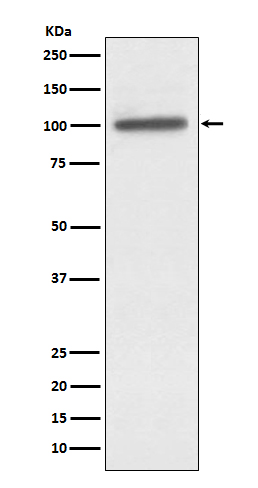alpha Actinin 4