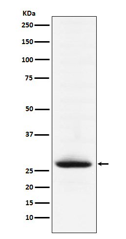 Myelin oligodendrocyte glycoprotein