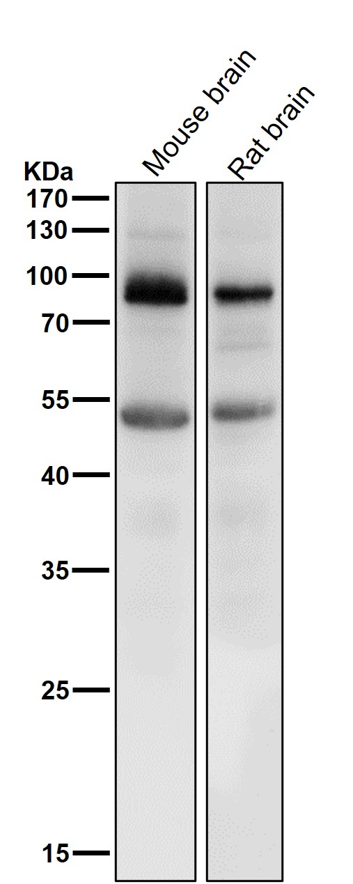 Prolactin Receptor