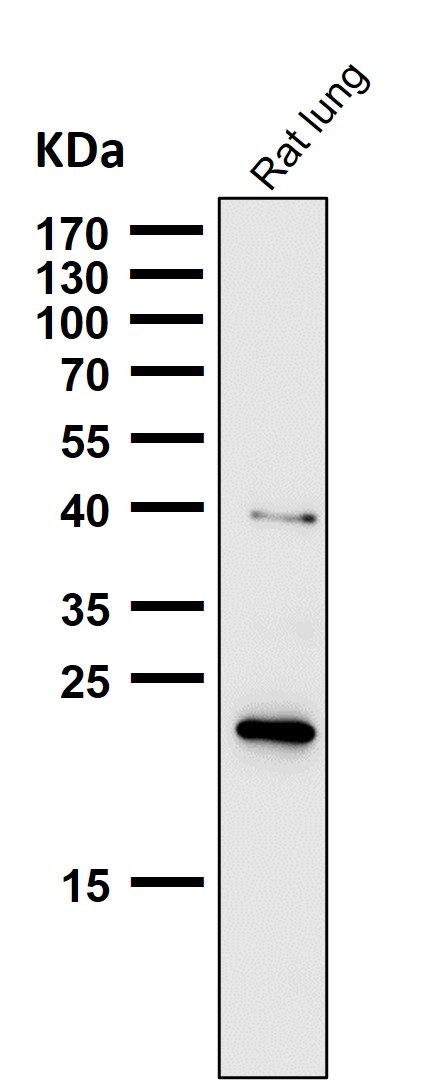 Ferritin Heavy Chain