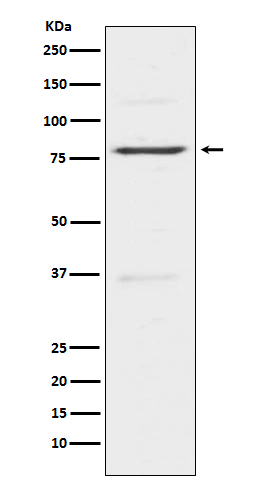 Insulin Receptor R