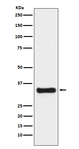 Thymidylate Synthase