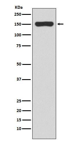 RNA polymerase beta