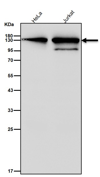 Rabbit Monoclonal to PHF8