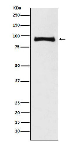 MALT1