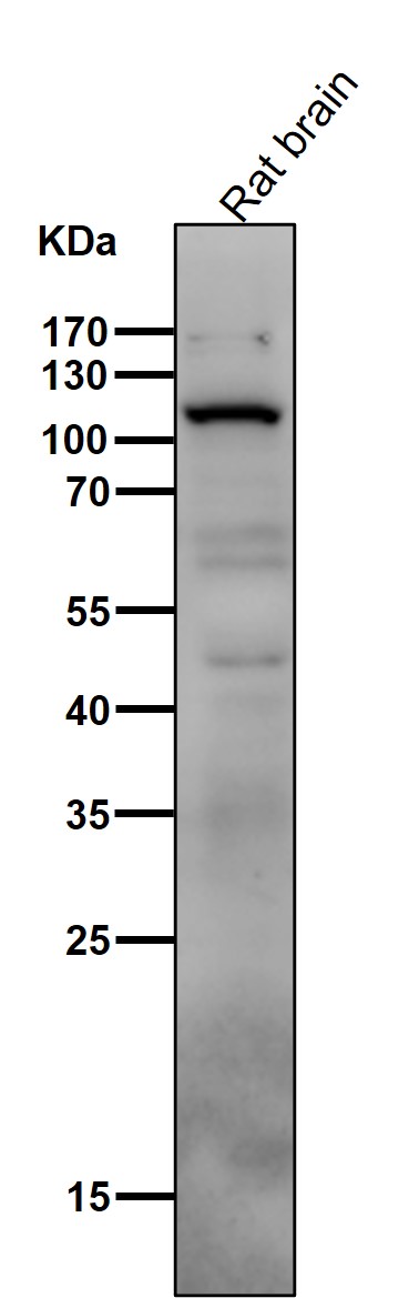 PI3 Kinase p110 delta