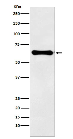 Factor IX