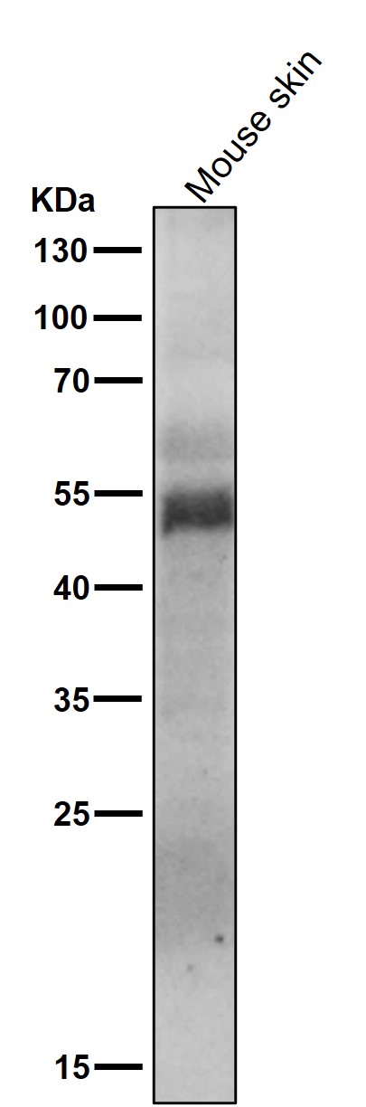 Phospho-MLKL(S358)