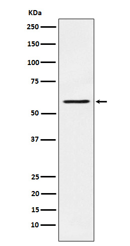 PAK1