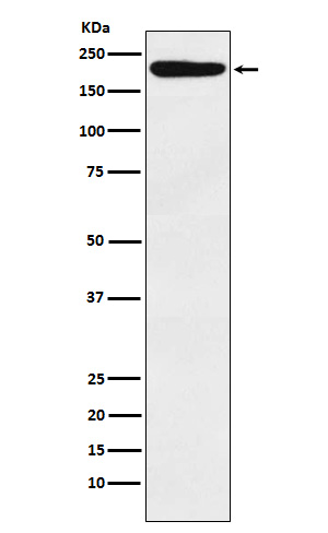IQGAP1