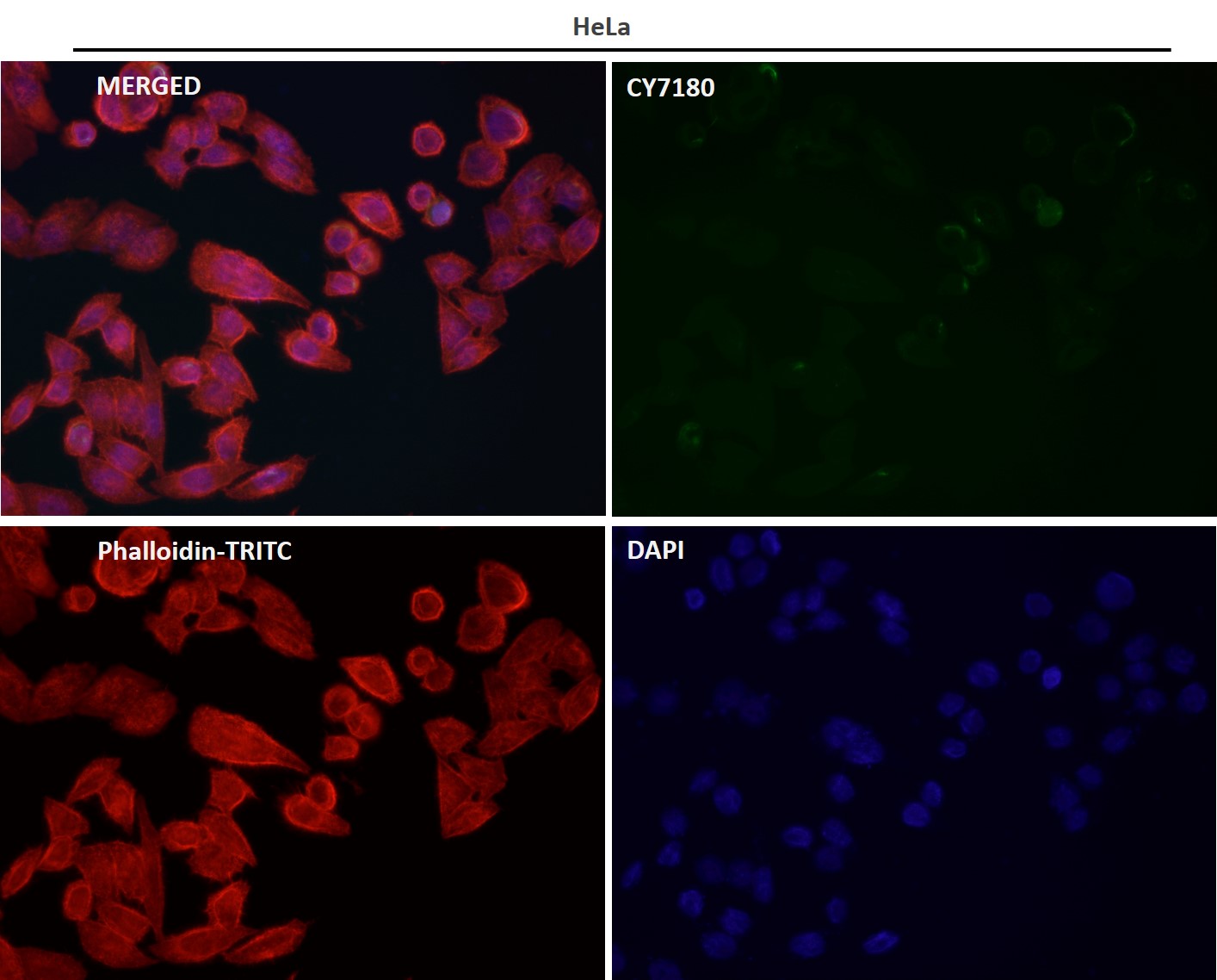 Rabbit Monoclonal to HuR/ELAVL1