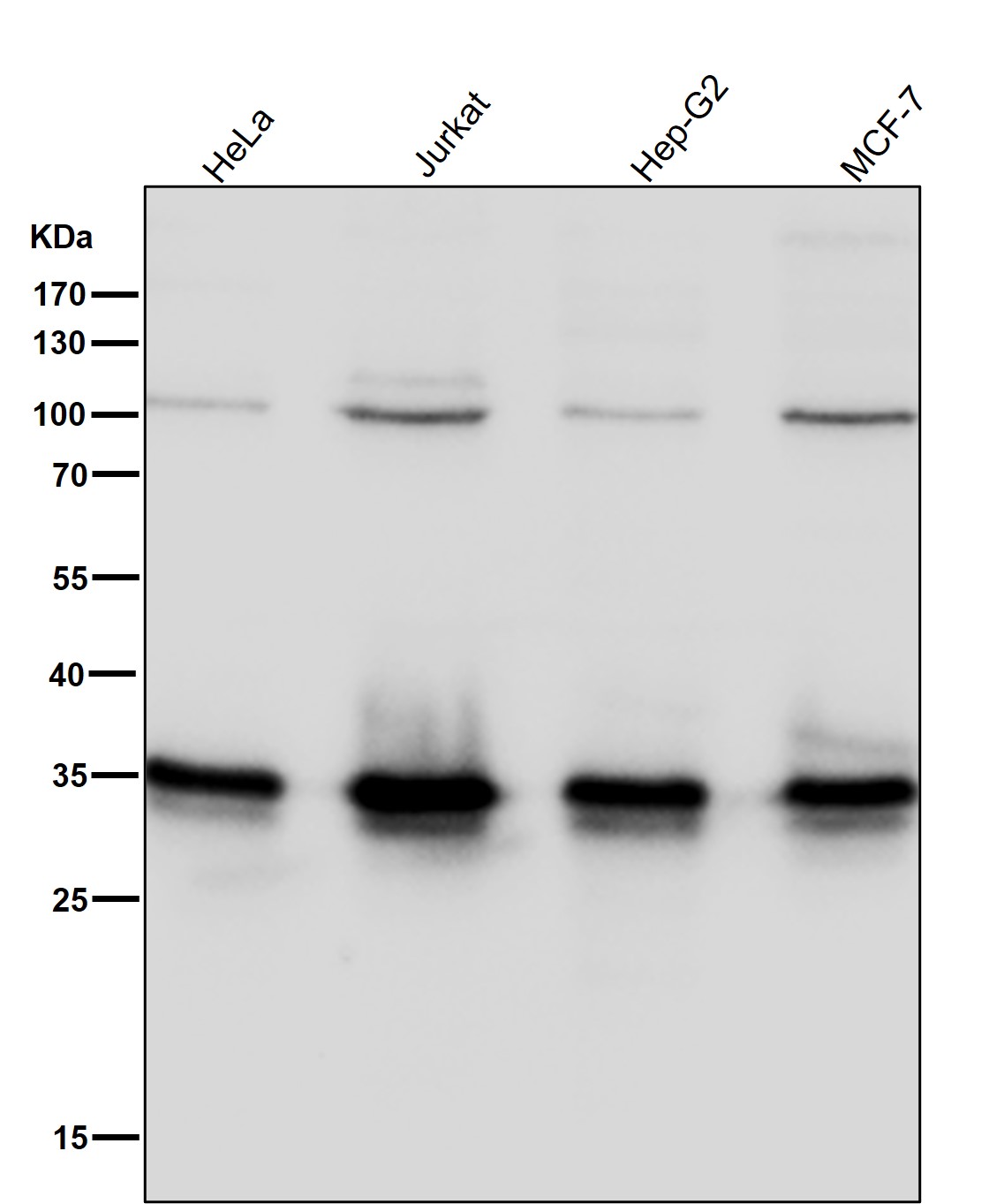 Rabbit Monoclonal to HuR/ELAVL1