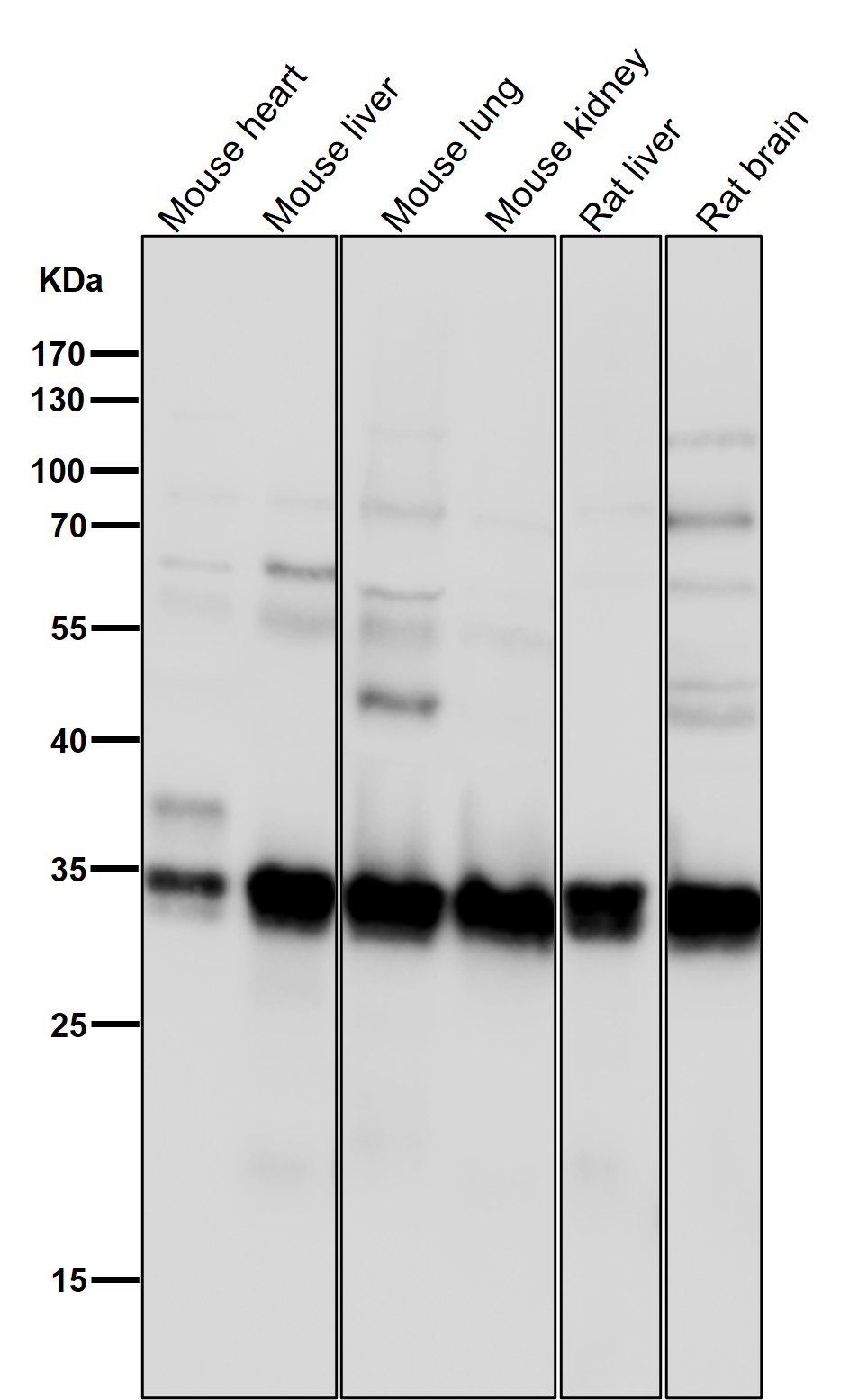 Rabbit Monoclonal to HuR/ELAVL1