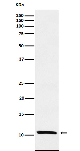 Estrogen Inducible Protein pS2