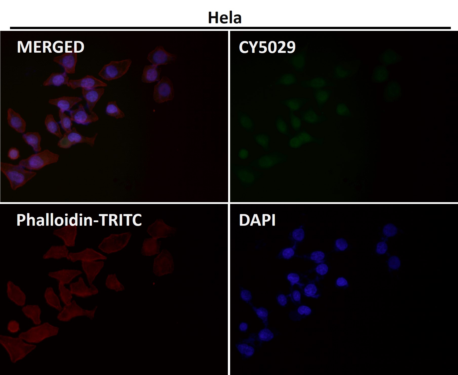 Rabbit Monoclonal to PFKFB3