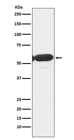 Rabbit Monoclonal to PFKFB3
