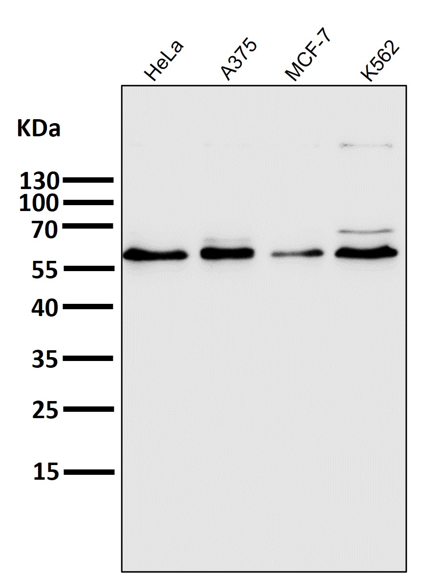 Rabbit Monoclonal to PFKFB3