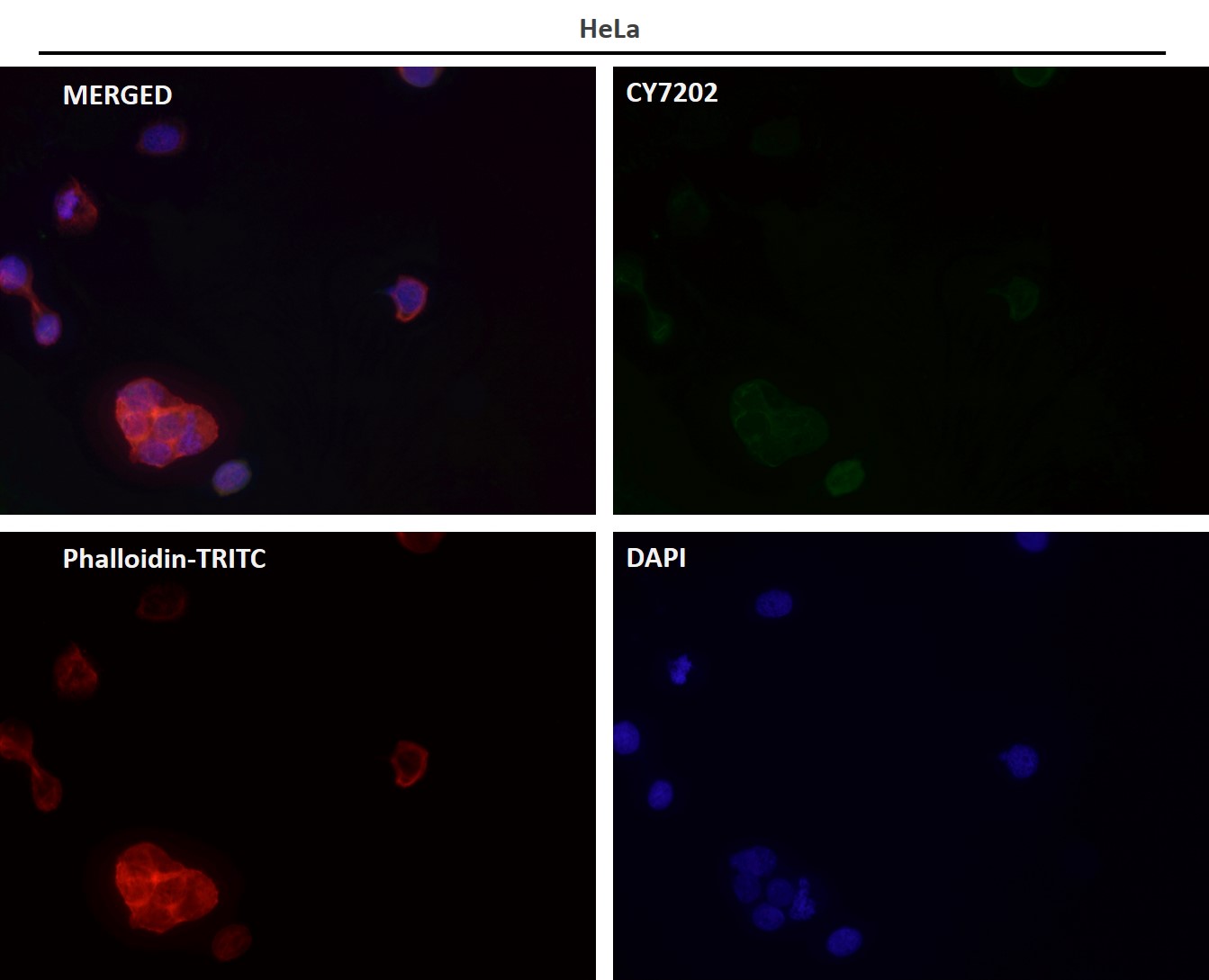 Rabbit Monoclonal to GCLM