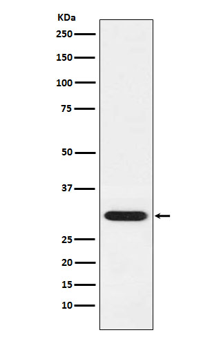 Rabbit Monoclonal to GCLM