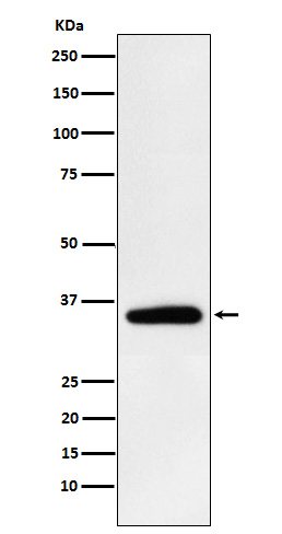 Pyruvate Dehydrogenase E1 beta subunit
