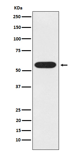 UAP1