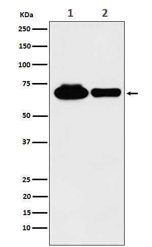 Rabbit Monoclonal to METTL3