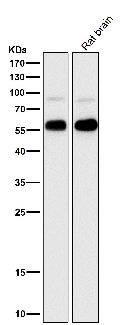 METTL3