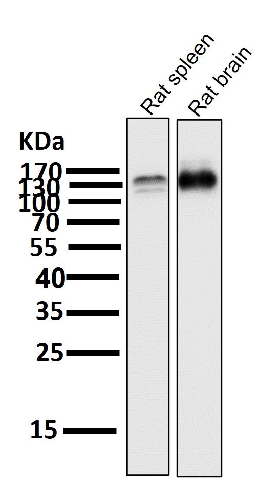 Anti-TrkB