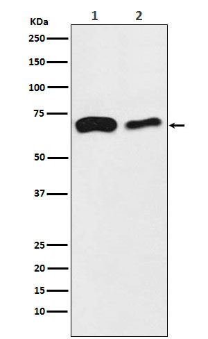 SLC27A4/FATP4