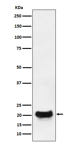 DCTN5