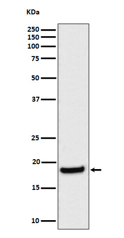 eIF1A
