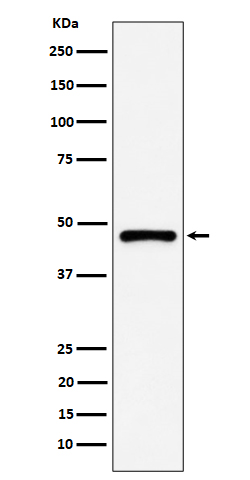 PSMC5