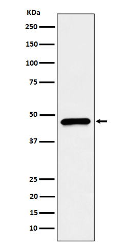 CECR5