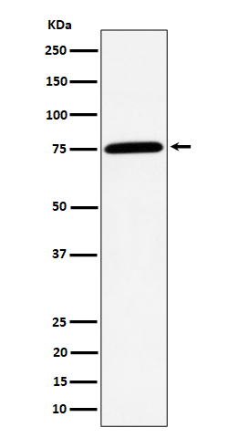 PPM1G