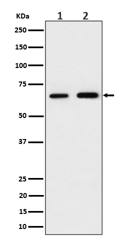 PGM1