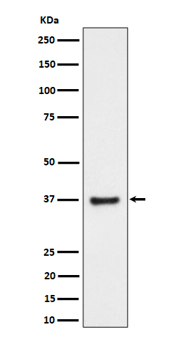 RNF115