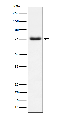 PWP1